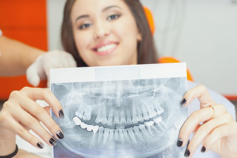 woman holding an x-ray of her teeth