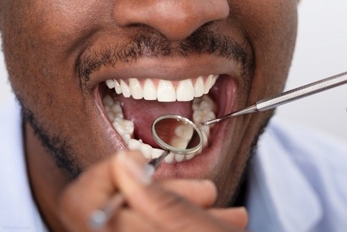 healthy gums being examined by dentist