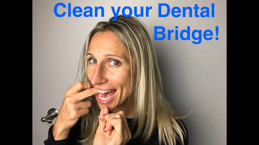 How To Remove Stains From Dental Bridges? How To Remove Stains From