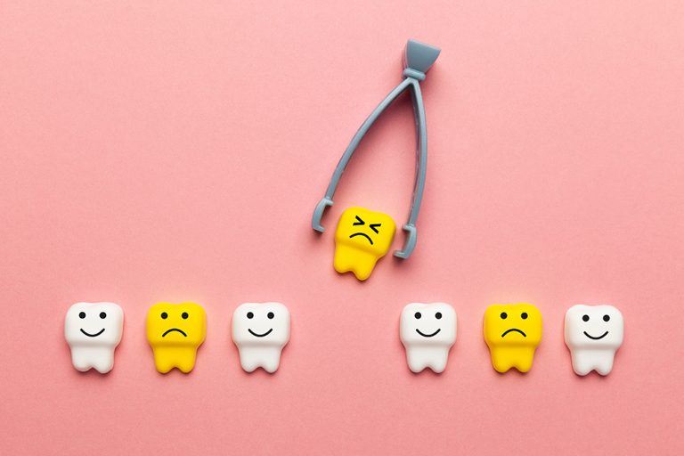 Does Guardian Dental Cover Wisdom Teeth Extraction? Dentist Norcross