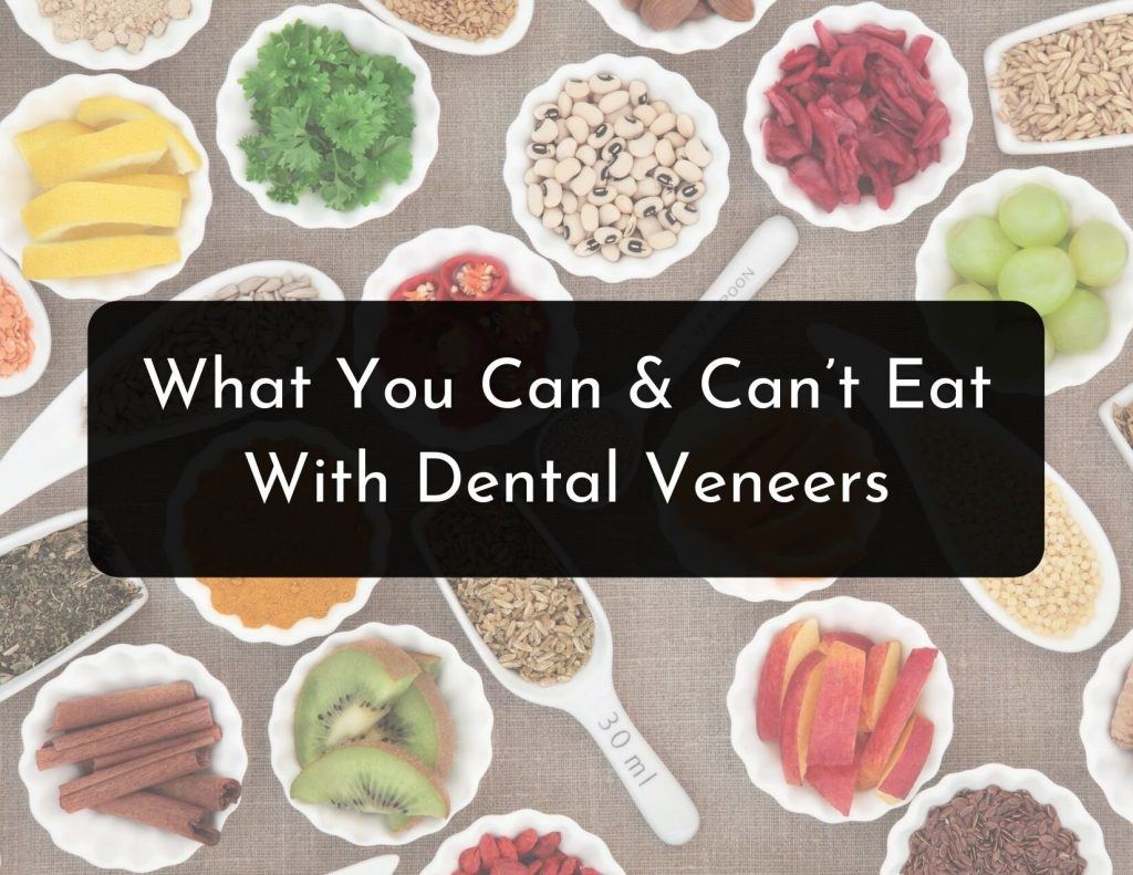Can You Eat With Dental Veneers? | Dentist Norcross & Alpharetta, GA