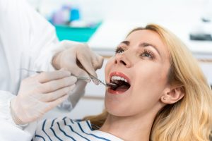 Before and after dental results